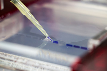 Agarose gel electrophoresis is a method of gel electrophoresis used in biochemistry, molecular...