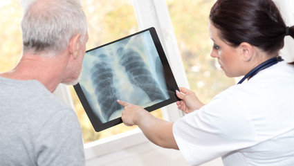 Doctor showing x-ray report to patient