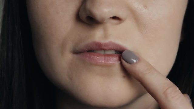 Herpes On Lips of The Young Woman. Woman Smears Herpes With Herpes Cream