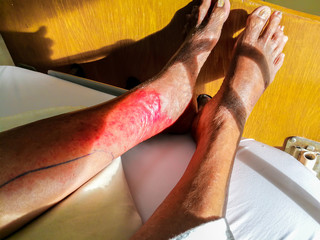 Obraz premium Allergy Medicine, Hand, Human Hand, Human Skin, Medicine