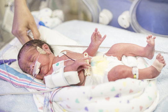 Mother Touching Her Premature Newborn Baby As He Is Hooked Up To An IV And Health Monitors While Being Treated In Intensive Care