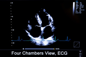 Colourful image of homan heart ultrasound monitor