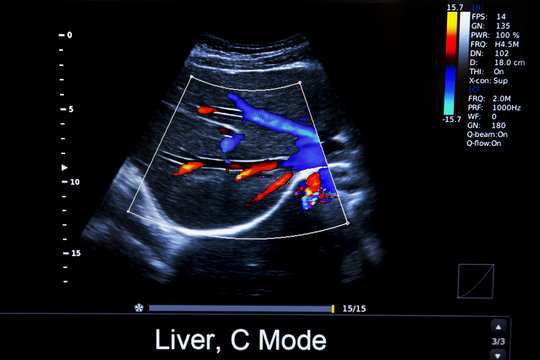 Colourful image of modern ultrasound monitor