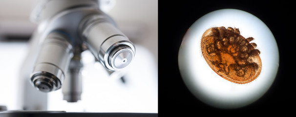 Varroa destructor bee parasite - microscope photo