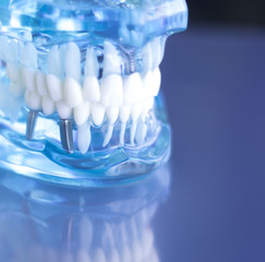 Dentsts dental teeth model