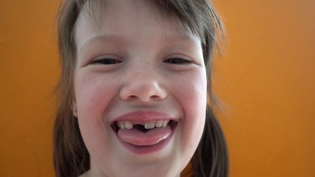 Little Girl With No Front Baby Tooth Smiling