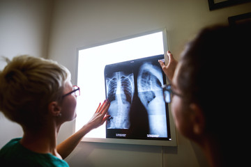 Rear close up view of two professional nurses with eyeglasses looking on the x-ray of a patient.