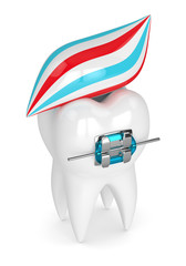 3d render of tooth with brace and toothpaste