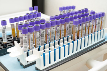 test tubes with blood