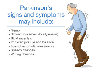 Illustration about Parkinson's disease symptoms and sign. Health problem of elderly people with abnormal nervous system.
