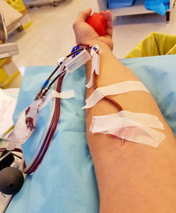 blood sampling and patient arm during blood transfusion with the