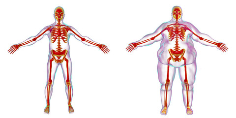 Obesity problem conceptual image, 3D illustration showing normal wieght man and normal skeleton inside obese male body - obrazy, fototapety, plakaty