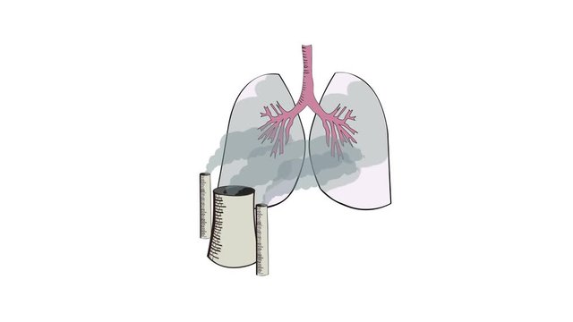 Animation of industrial pollution and pulmonary health
