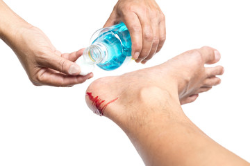 Nurse cleaning wound on patient with  Isopropyl alcohol isolated in clipping path