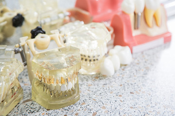 Fototapeta na wymiar макет челюсти и зубов лежит на столе у дантиста