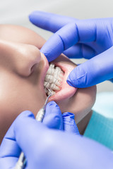 улыбка девушки с брекетами, а рука врача лечит зубы