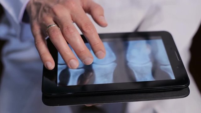 Doctor looking X-ray on the tablet