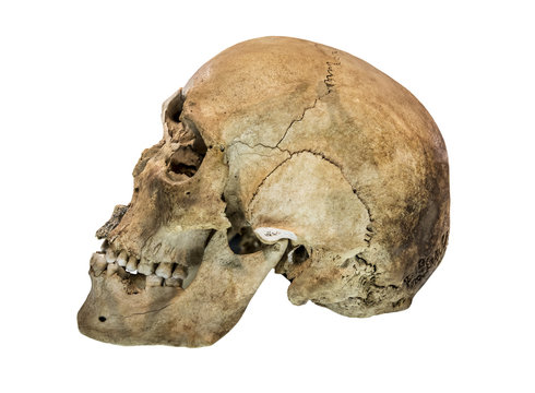 Left side view of human skull.