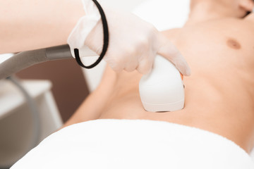 The man came to the procedure of laser hair removal. The doctor treats his stomach with a special...