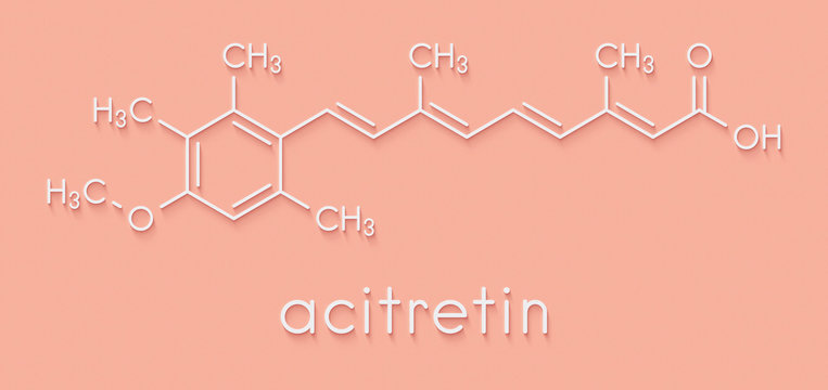 Acitretin psoriasis drug molecule. Skeletal formula.