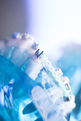 Dental teeth metal brackets