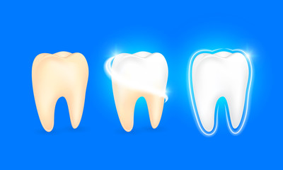 Set of  clean and dirty tooth. Step of yellow to white. Dental care concept, illustration isolated on blue background.