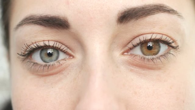 girl with different eyes looks at the camera, heterochromia, close-up