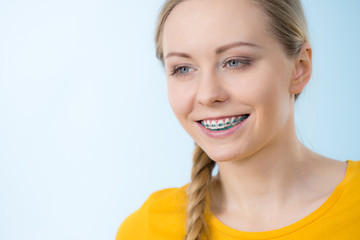 Woman showing her teeth with braces