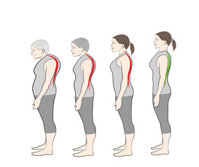 Fototapeta premium Development of a stooped stance with age, showing increasing curvature of the spine