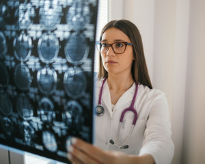 Female doctor looking at x-ray image scan of a brain