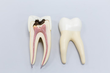  Tooth model for classroom education and in laboratory.