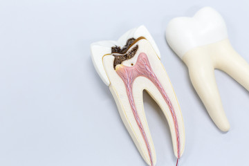  Tooth model for classroom education and in laboratory. - obrazy, fototapety, plakaty