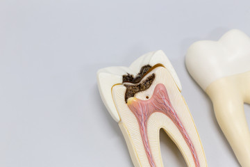 Tooth model for classroom education and in laboratory.