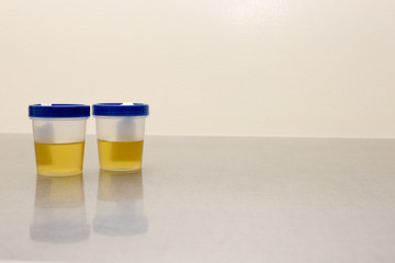 Drug Test Urinalysis