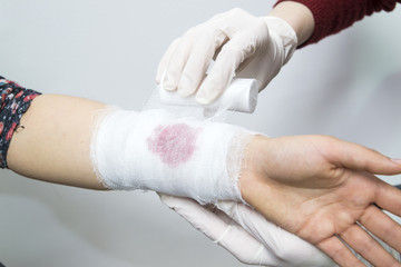 Bandaging a bleeding injury on the forearm using a white bandage