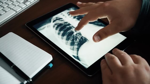 Doctor looking at tablet with X-ray of a human chest or lungs radiography shot, modern medical diagnostic concept