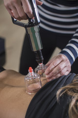 Cupping Procedure