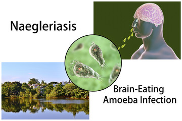 Brain-eating amoeba infection, naegleriasis. Image shows water reservoir as a potential source of infection, 3D illustration of Naegleria fowleri parasite and nasal passage of amoebas to brain