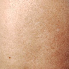 Fototapeta premium human skin texture
