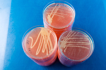 Petri dishes with biological samples  for medical and biological analyzes