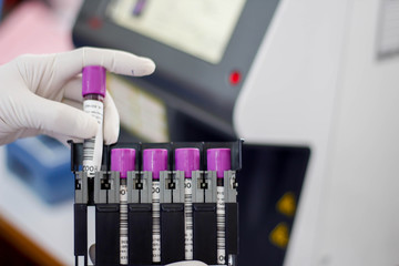 Scientists tested with automated hematology analysis in laboratory