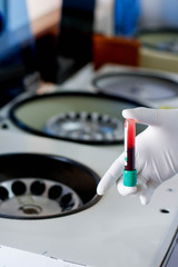 Hand holding test tube with blood plasma ready for testing in laboratory