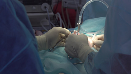 Obraz na płótnie Canvas Operation using laparoscopic equipment. Surgeons team. Hospital.