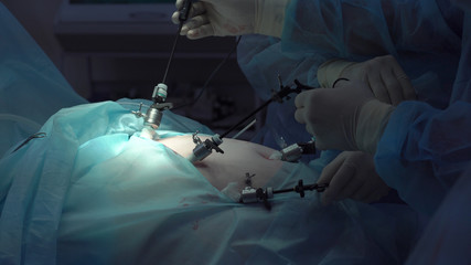 Operation using laparoscopic equipment. Surgeons team. Hospital.