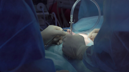 Operation using laparoscopic equipment. Surgeons team. Hospital.