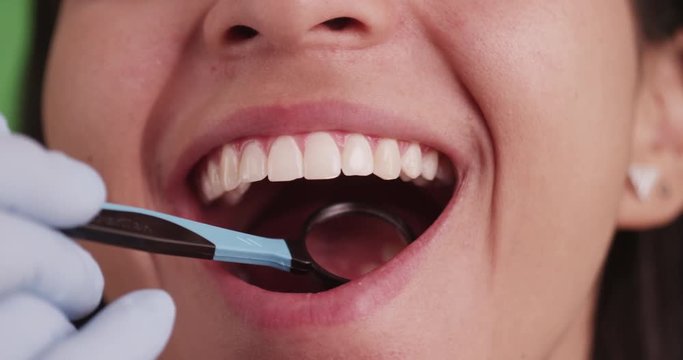 Hispanic girl smiling while getting her teeth checked on green screen. On green screen to be keyed or composited. 