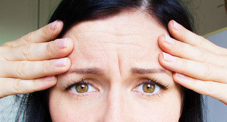 thirty years. Wrinkles on the forehead. Face plastic. 