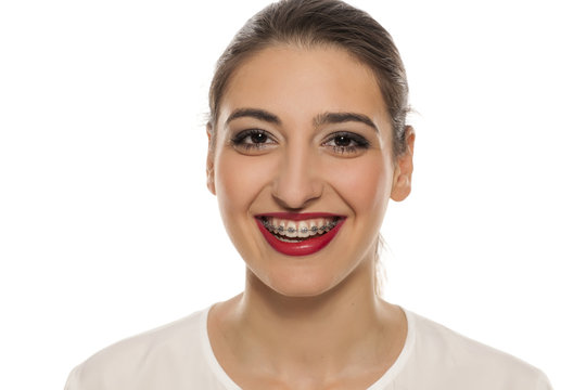 Young smiling woman with braces on white background