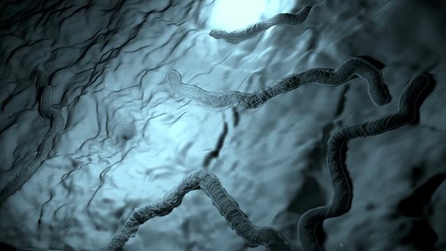 Bacteria in detail, HELICOBACTER PYLORI, live bacteria, culture bacteria on an organic surface, bacteria and causes Salmonellosis and food poisoning, Ebola virus in the organism