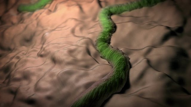 Bacteria in detail, HELICOBACTER PYLORI, live bacteria, culture bacteria on an organic surface, bacteria and causes Salmonellosis and food poisoning, Ebola virus in the organism